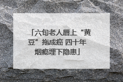 六旬老人唇上“黄豆”拖成癌 四十年烟瘾埋下隐患